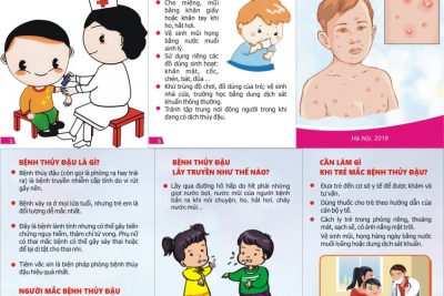 PHÒNG CHỐNG THUỶ ĐẬU